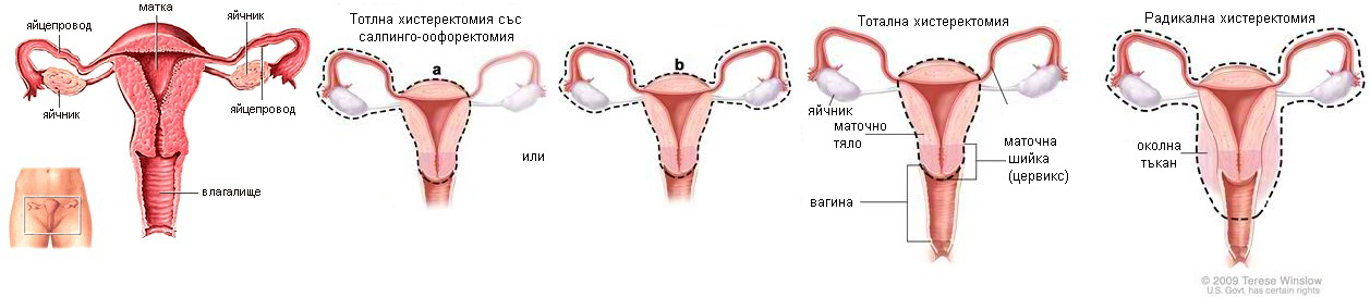 Сдружение на пациентите с ГИСТ в България